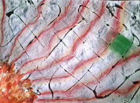 Abstract painting: Repairing the Network